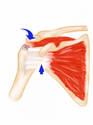 ¿Qué músculos llevan hacia atrás los Hombros? ¿qué músculos llevan hacia atrás los hombros? ¿Qué Músculos llevan hacia atrás los Hombros? m  sculo subescapular anatom  a