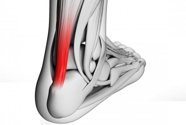 Prevención de lesiones en tendones prevención de lesiones en tendones Prevención de Lesiones en Tendones prevenci  n lesiones tendones 1